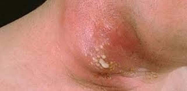 Dr.Kashid Hospital & Piles Clinic